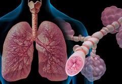 Блог "Обсуждаем проблемы лечения Бронхиальной астмы"