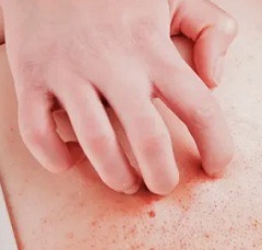 Причины контактного дерматита3