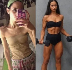 Причины анорексии2