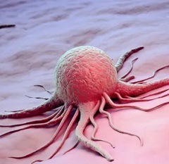 Причины рака1