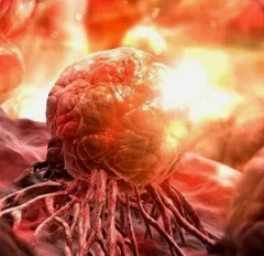 Причины рака3