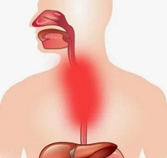 Лечение ожогов пищевода у детей3